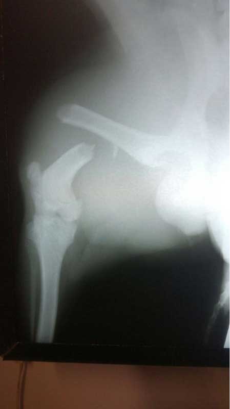 fractured dog femur
